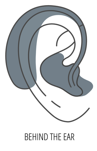 Diagram of a Behind-the-Ear (BTE) hearing aid