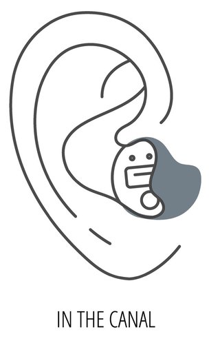 Diagram of an In-the-Canal (ITC) hearing aid