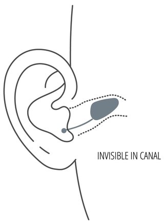 Diagram of an Invisible-in-Canal (IIC) hearing aid